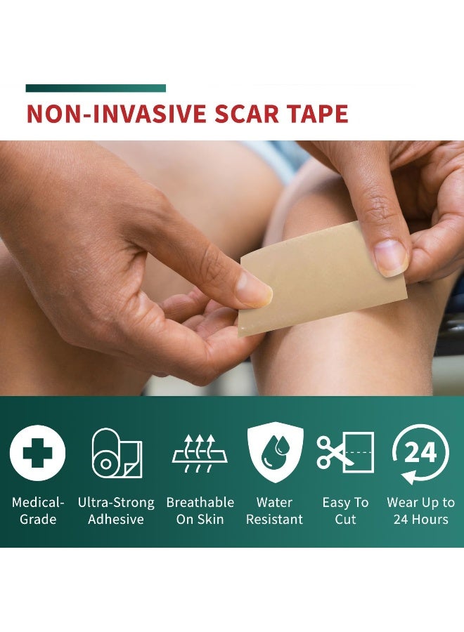 Protect Life Medical-Grade Silicone Scar Tape Roll (4cm x 300cm Roll) - Keloid Bump Removal Scar Sheets - Reusable Silicone Tape Scar Removal Strips, Scar Tape for Surgical Scars, C Section Scar Silicone Strips - Image 3